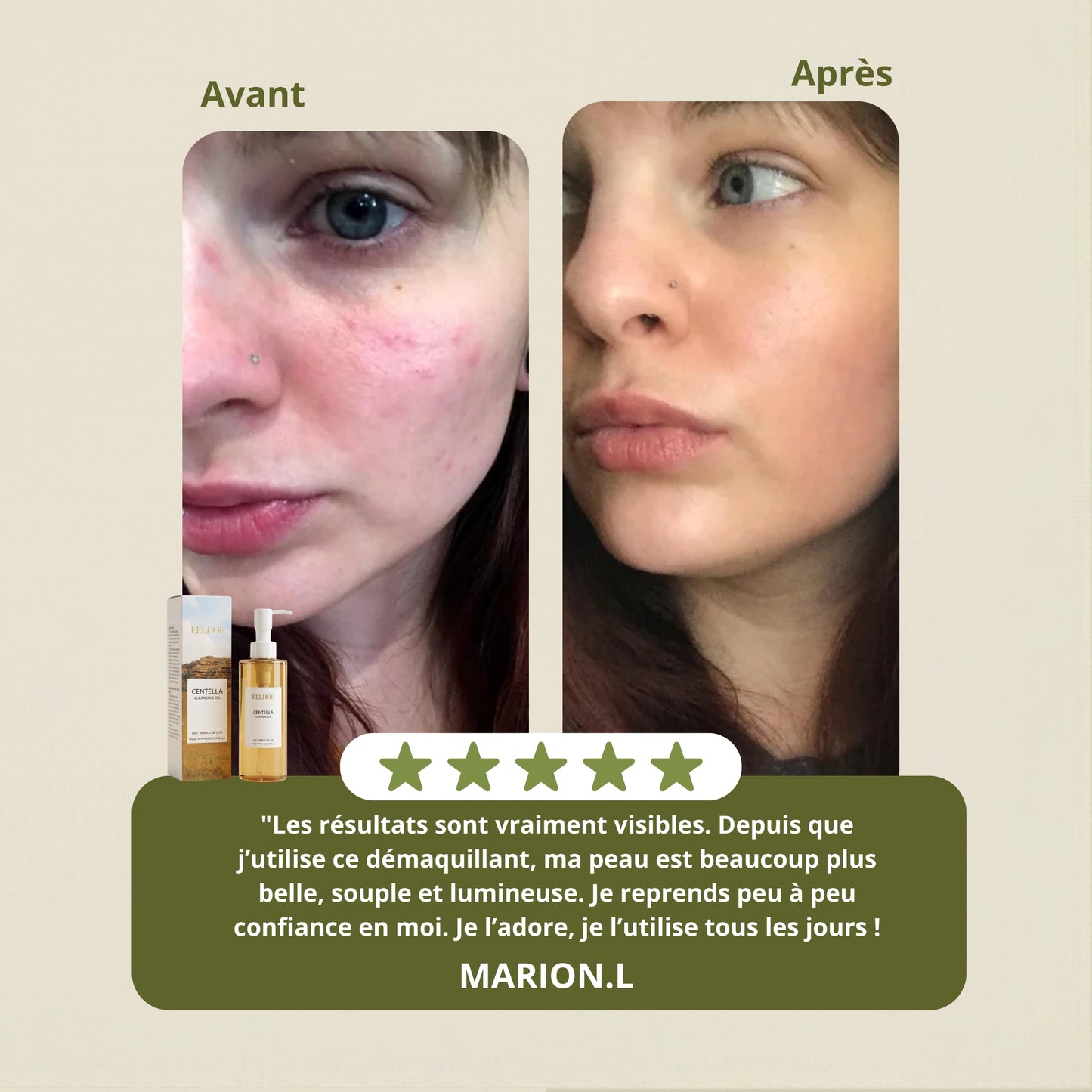 Huile Démaquillante Douce – Nettoyant & Soin